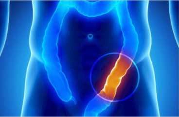 Το παχύ έντερο: 8 πράγματα που πρέπει να γνωρίζετε