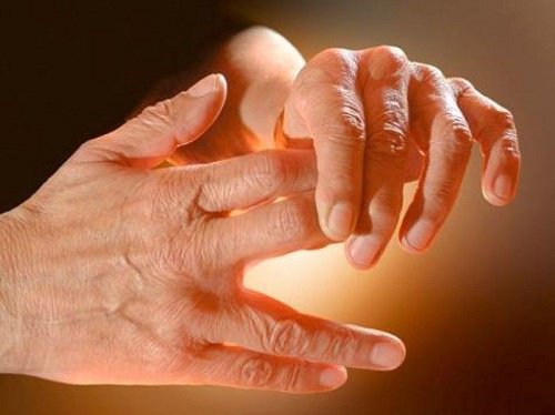 Γιατί μυρμηγκιάζουν τα χέρια και τα πόδια σας;