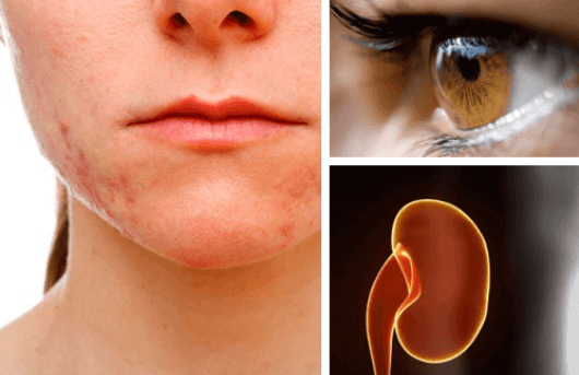 Ποια όργανα επηρεάζει το στρες περισσότερο και γιατί