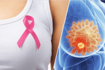 10 προειδοποιητικά σημάδια του καρκίνου του μαστού
