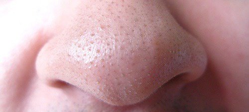 Ακμή και μαύρα στίγματα: το πράσινο τσάι μπορεί να βοηθήσει