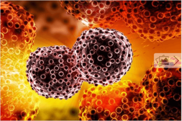 Οι ειδικοί προτείνουν 9 τρόπους για να αποφύγετε τον καρκίνο