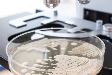 Αντιμετώπιση της Candida: 10 φυσικές τροφές