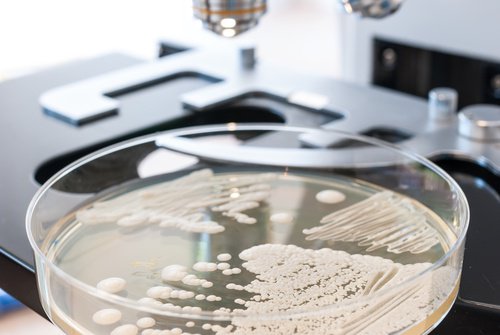 Αντιμετώπιση της Candida: 10 φυσικές τροφές