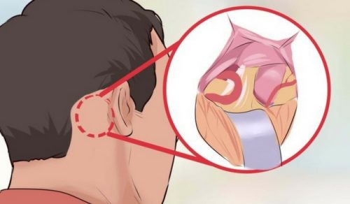 5 πράγματα που πρέπει να γνωρίζετε για τη νευραλγία τριδύμου