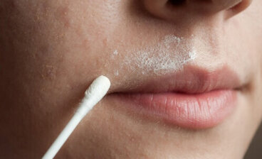 Κόλπα για την αφαίρεση τριχών από ανεπιθύμητες περιοχές