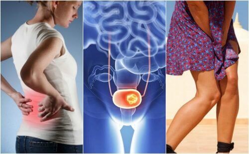 7 σημάδια του καρκίνου της ουροδόχου κύστης