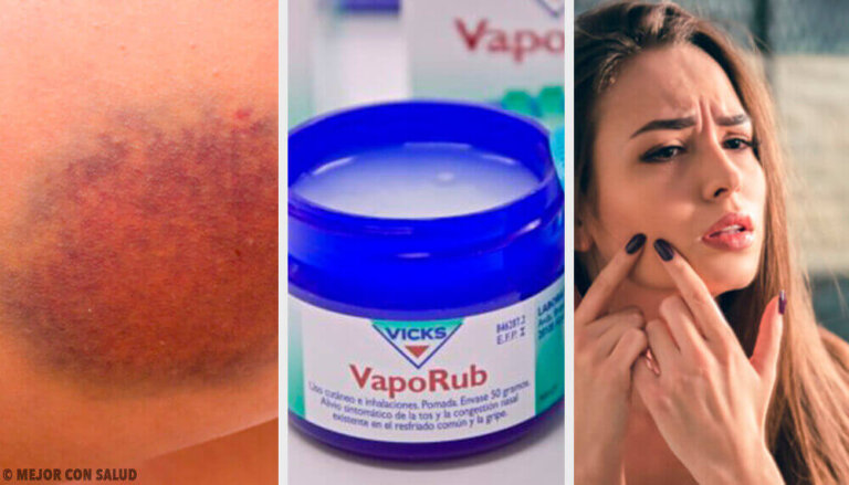 11 εκπληκτικές χρήσεις για το διάσημο Vicks VapoRub