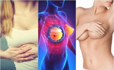 Καρκίνος του μαστού: 9 συμπτώματα που πρέπει να ξέρετε