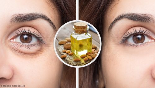 4 μάσκες για την εξάλειψη των μαύρων κύκλων