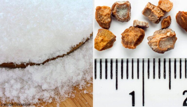 7 συστατικά για να απαλλαγείτε από τις πέτρες στα νεφρά