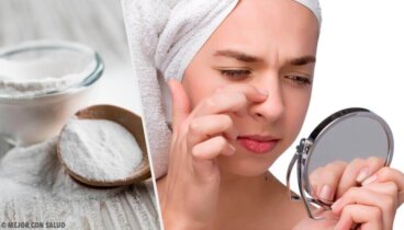 4 μάσκες με μαγειρική σόδα για να αφαιρέσετε τα μαύρα στίγματα