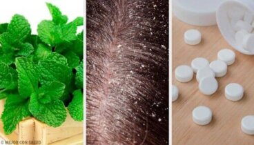 7 σπιτικές θεραπείες για την αντιμετώπιση της πιτυρίδας