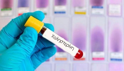 Μειώστε την υψηλή χοληστερίνη με αυτές τις έξι θεραπείες με βότανα