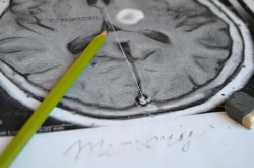 Πρόληψη και συμπτώματα της αμνησίας