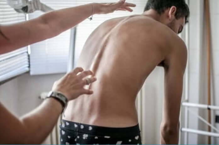 Τέσσερις βασικές ασκήσεις για να αποτρέψετε τη σκολίωση
