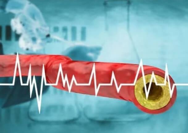 Πώς να διατηρήσετε τη χοληστερόλη σταθερή με διατροφή