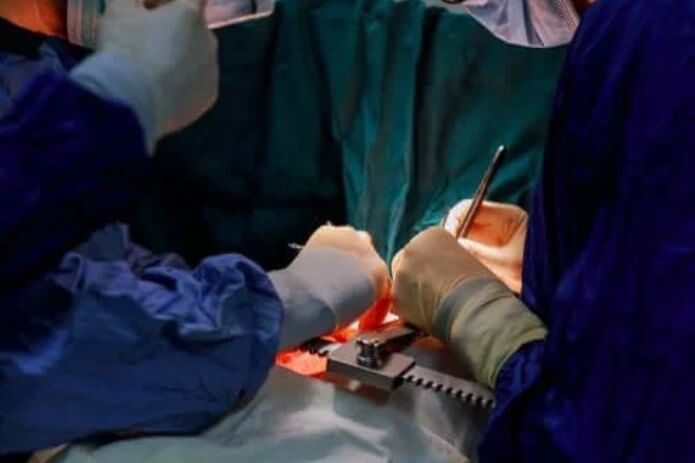 Αορτική ανατομή: Όλα όσα πρέπει να γνωρίζετε