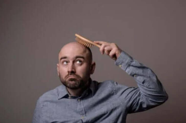 Όλοι οι διαφορετικοί τύποι της αλωπεκίας