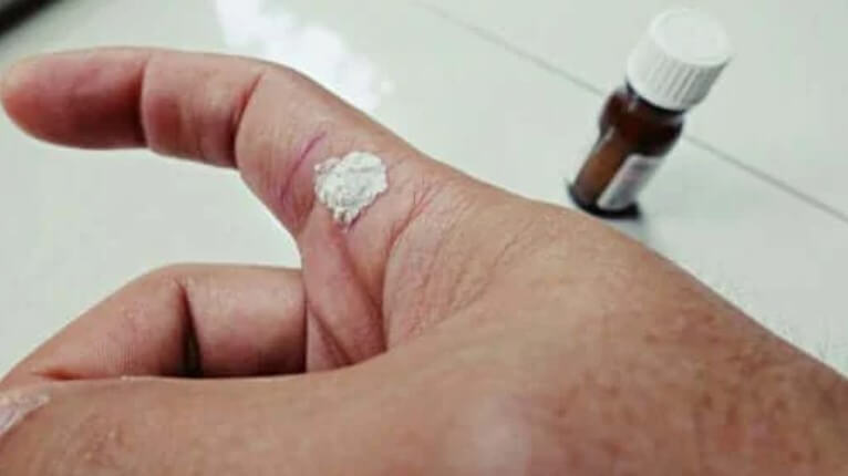 Σαλικυλικό οξύ: Τι πρέπει να ξέρετε για αυτό