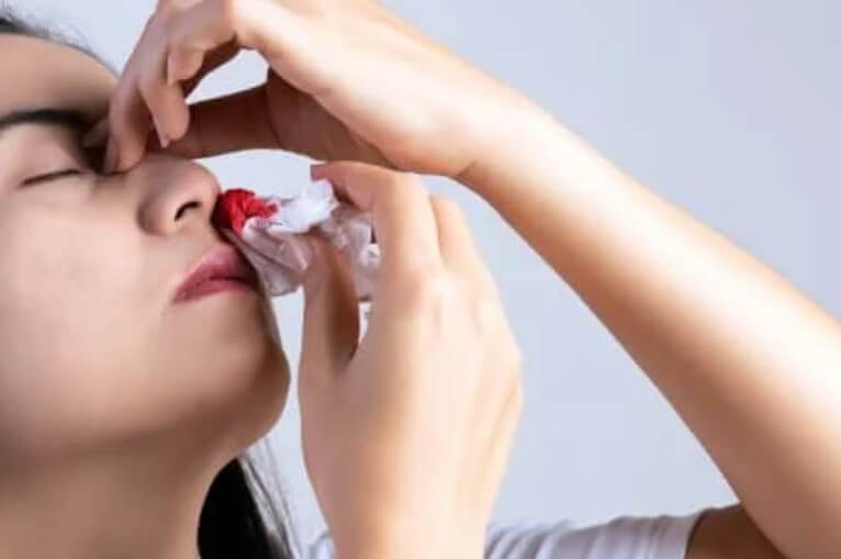 9 βασικές αιτίες για την αιμορραγία της μύτης
