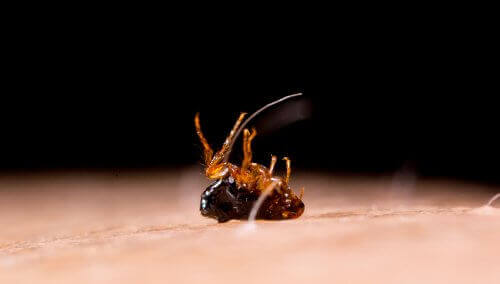 Τουνγκίαση: Τα συμπτώματα και η θεραπεία της