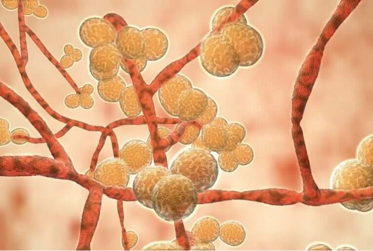 Candida Auris: Ένας μύκητας που μπορεί να σκοτώσει