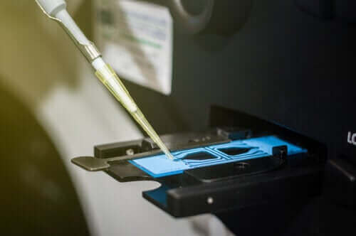 Πώς να ερμηνεύσετε τα αποτελέσματα ενός σπερμοδιαγράμματος