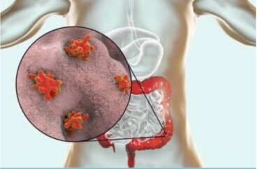 Ασθένειες που προκαλούνται από πρωτόζωα: Ποιες είναι;