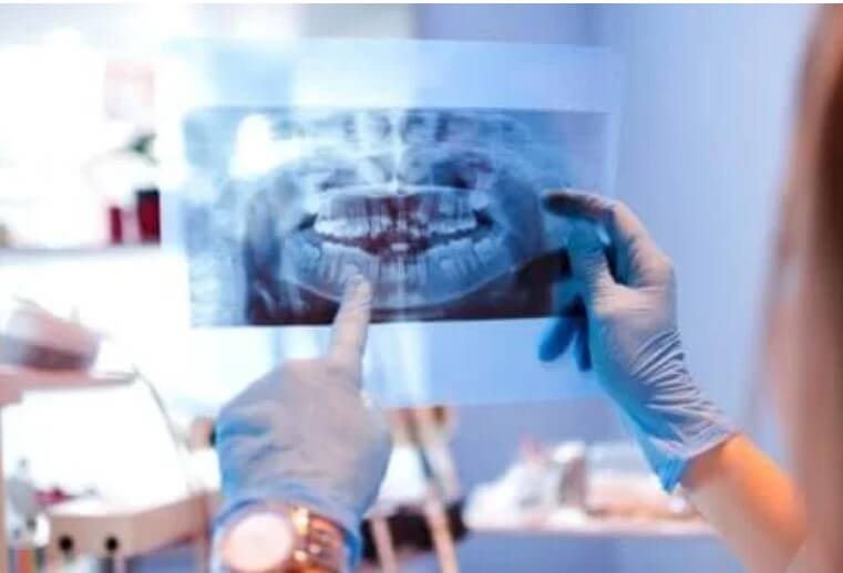 Αιτίες για την εξάρθρωση της κροταφογναθικής άρθρωσης