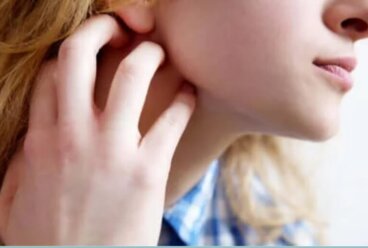 Φαγούρα στο δέρμα ή κνησμός: Συμπτώματα, αιτίες