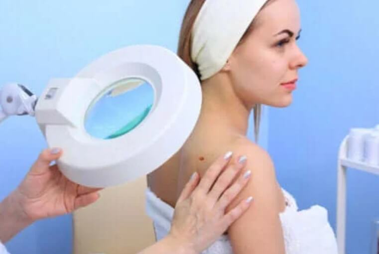 Καλοήθεις όγκοι: Όλα όσα πρέπει να γνωρίζετε