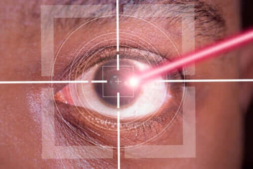 Επέμβαση LASIK: Πλεονεκτήματα και μειονεκτήματα