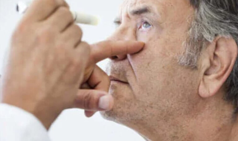 Γλαύκωμα: Όλα όσα πρέπει να ξέρετε για αυτό