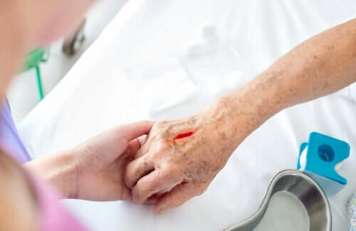 Νεκρωτική απονευρωσίτιδα: Όλα όσα πρέπει να γνωρίζετε