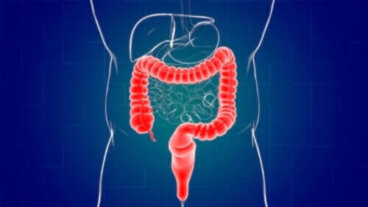 Πρωκτίτιδα: Τι προκαλεί και πώς αντιμετωπίζεται;