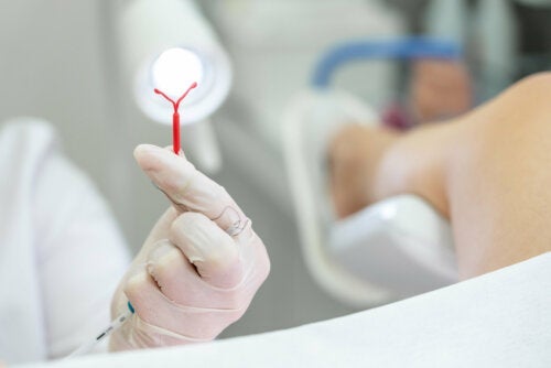 Ενδομήτριο σπείραμα ή σπιράλ (IUD): Τι είναι;