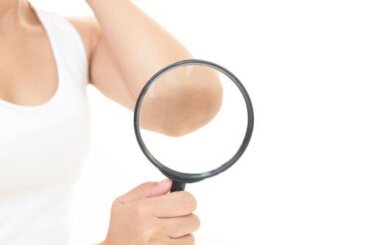 Πώς να απαλλαγείτε από μαύρους αγκώνες και γόνατα