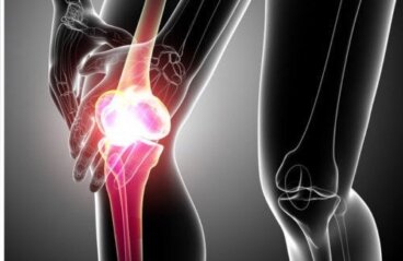 Πώς να καταπραΰνετε τα συμπτώματα της τενοντίτιδας