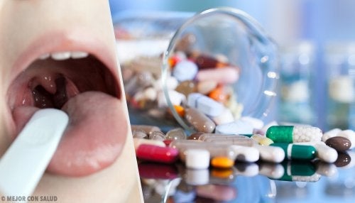 Θεραπεία για την οξεία αμυγδαλίτιδα