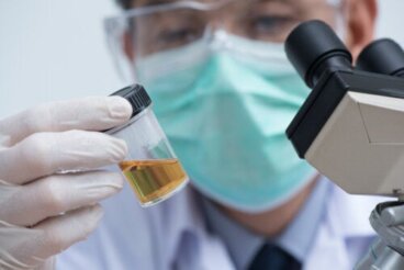 Αφρώδη ούρα: Αιτίες και πότε να αναζητήσετε βοήθεια