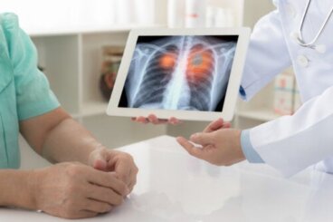 Κηλίδα στον πνεύμονα: Κύριες αιτίες και θεραπεία