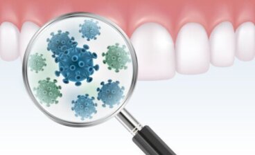 Όλα όσα πρέπει να γνωρίζετε για την οδοντική βακτηριακή πλάκα