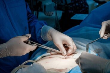 Μεταμόσχευση δέρματος: Πότε γίνεται;