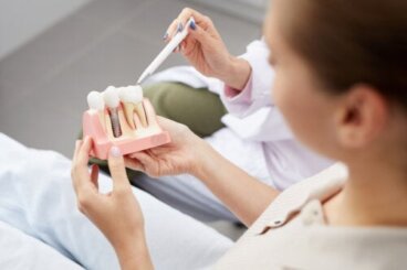Οδοντικά εμφυτεύματα: Τι είναι και πώς χρησιμοποιούνται