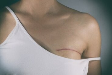 Χειρουργικές επεμβάσεις για τη θεραπεία του καρκίνου του μαστού
