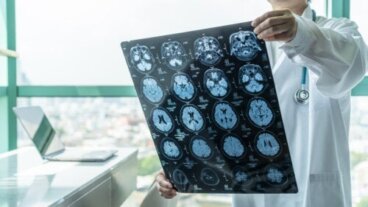 Μονάδα Εγκεφαλικών Επεισοδίων: Τι είναι και ποια τα οφέλη της