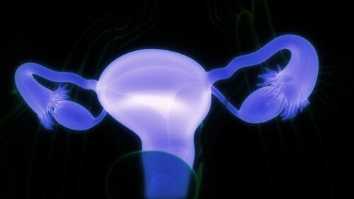 Δερμοειδείς κύστεις των ωοθηκών: Συμπτώματα και επιπλοκές