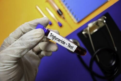 Επίπεδα τριγλυκεριδίων: Τι πρέπει να γνωρίζετε;