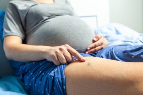 Φλεβίτιδα στην εγκυμοσύνη: Συμπτώματα και θεραπεία